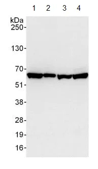 Western blot - Anti-PKM antibody (AB131021)