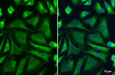 Immunocytochemistry/ Immunofluorescence - Anti-PKM antibody (AB137791)
