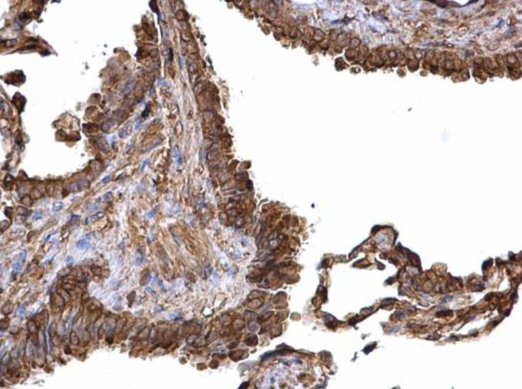 Immunohistochemistry (Formalin/PFA-fixed paraffin-embedded sections) - Anti-PKM antibody (AB137791)