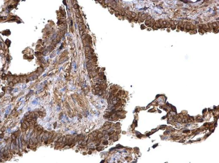 Immunohistochemistry (Formalin/PFA-fixed paraffin-embedded sections) - Anti-PKM antibody (AB137791)