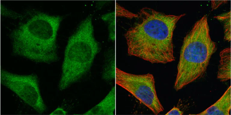 Immunoprecipitation - Anti-PKM antibody (AB137791)