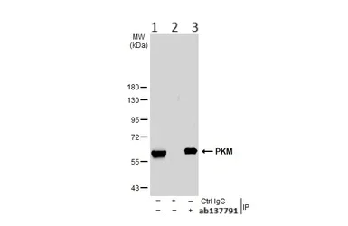 Immunoprecipitation - Anti-PKM antibody (AB137791)