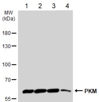 Anti-PKM antibody