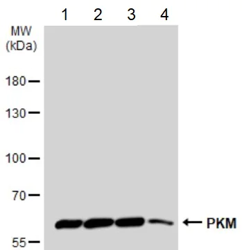 Western blot - Anti-PKM antibody (AB137791)