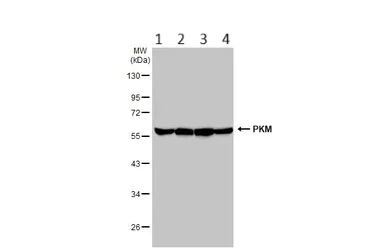 Western blot - Anti-PKM antibody (AB137791)