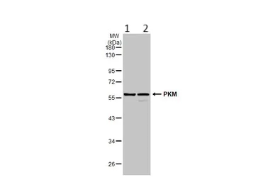 Western blot - Anti-PKM antibody (AB137791)