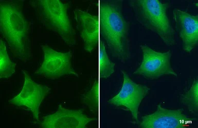 Immunocytochemistry/ Immunofluorescence - Anti-PKM antibody (AB137852)