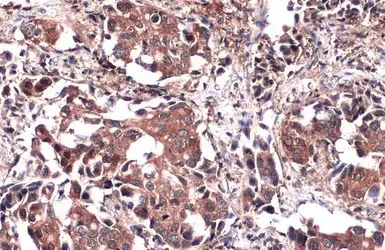 Immunohistochemistry (Formalin/PFA-fixed paraffin-embedded sections) - Anti-PKM antibody (AB137852)