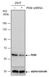 Western blot - Anti-PKM antibody (AB137852)