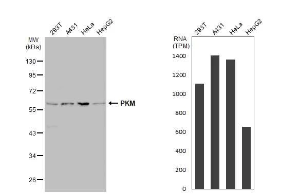 Western blot - Anti-PKM antibody (AB137852)