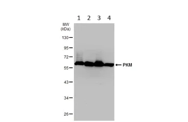 Western blot - Anti-PKM antibody (AB137852)