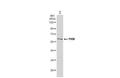 Western blot - Anti-PKM antibody (AB137852)