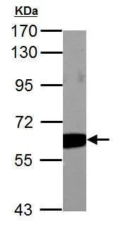 Western blot - Anti-PKM antibody (AB137852)