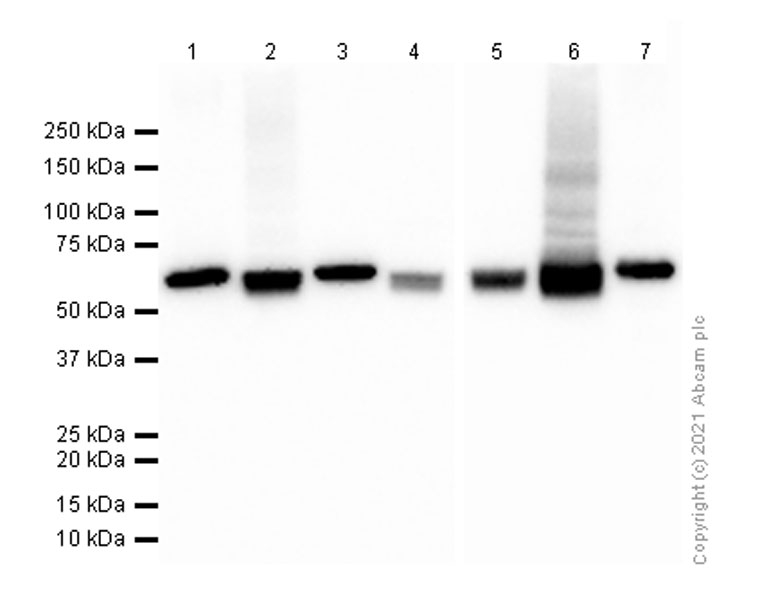 Western blot - Anti-PKM antibody [EPR10138(B)] (AB150377), expandable thumbnail