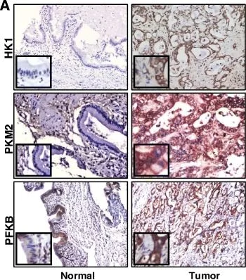 Western blot - Anti-PKM antibody [EPR10138(B)] (AB150377)