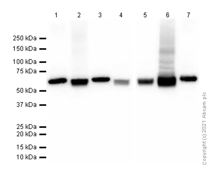 Western blot - Anti-PKM antibody [EPR10138(B)] - BSA and Azide free (AB206129)
