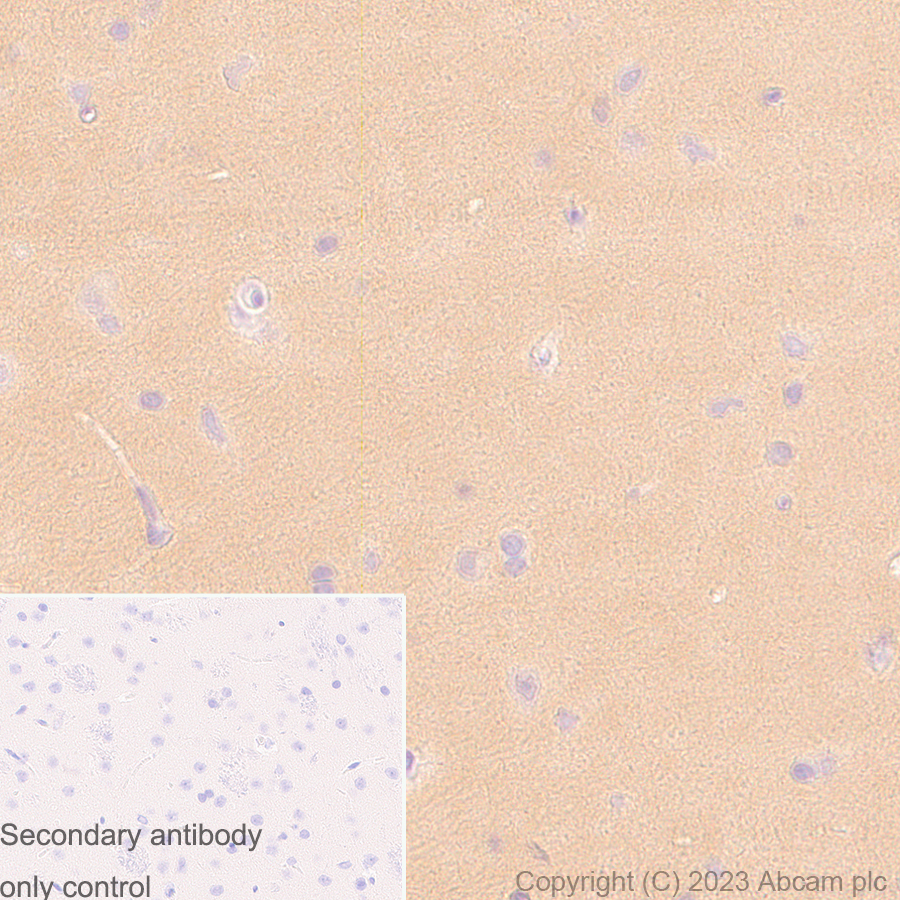 Immunohistochemistry (Formalin/PFA-fixed paraffin-embedded sections) - Anti-PKM antibody [EPR10139] (ab154816), expandable thumbnail
