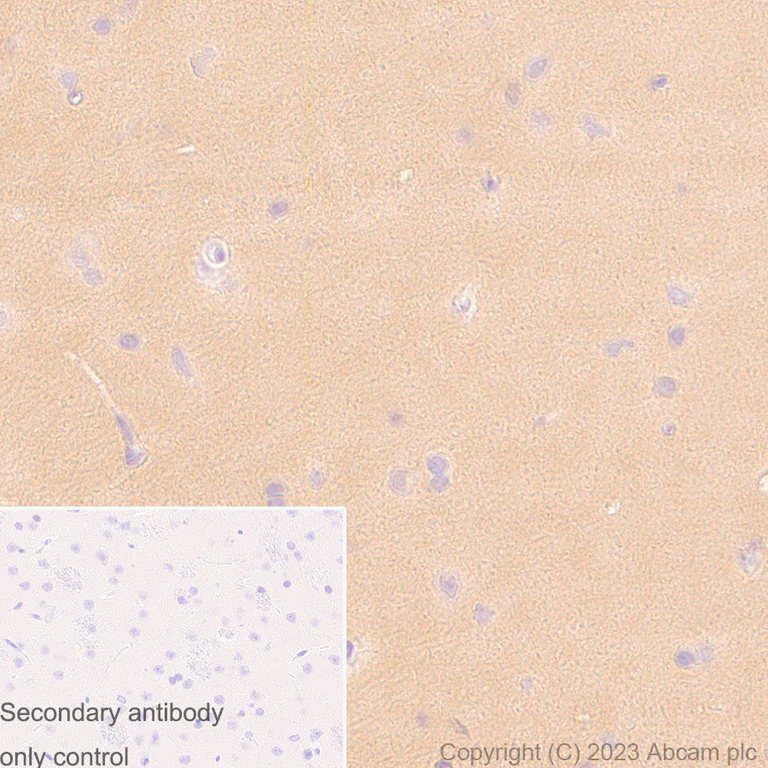 Immunohistochemistry (Formalin/PFA-fixed paraffin-embedded sections) - Anti-PKM antibody [EPR10139] (AB154816)