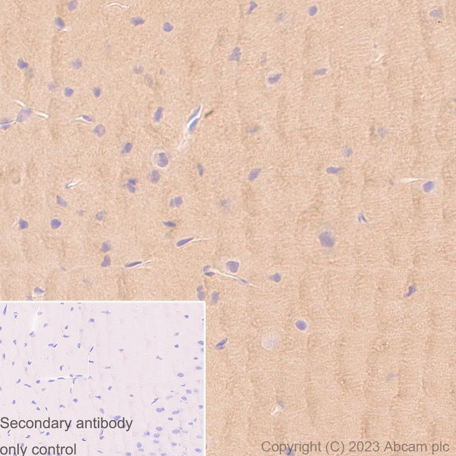 Immunohistochemistry (Formalin/PFA-fixed paraffin-embedded sections) - Anti-PKM antibody [EPR10139] (AB154816), expandable thumbnail