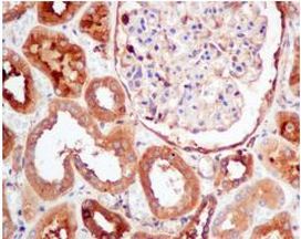 Immunohistochemistry (Formalin/PFA-fixed paraffin-embedded sections) - Anti-PKM antibody [EPR10139] (AB154816), expandable thumbnail