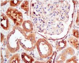 Immunohistochemistry (Formalin/PFA-fixed paraffin-embedded sections) - Anti-PKM antibody [EPR10139] (AB154816)