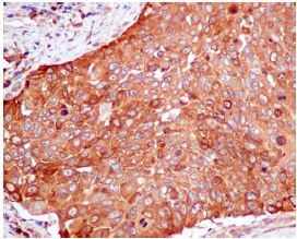Immunohistochemistry (Formalin/PFA-fixed paraffin-embedded sections) - Anti-PKM antibody [EPR10139] (AB154816), expandable thumbnail