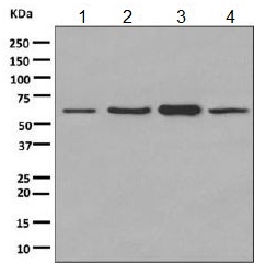 Western blot - Anti-PKM antibody [EPR10139] (AB154816), expandable thumbnail