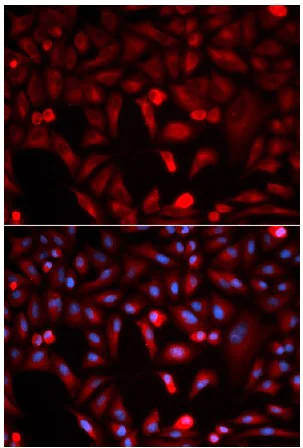 Immunocytochemistry/ Immunofluorescence - Anti-PKM antibody - N-terminal (AB196560)