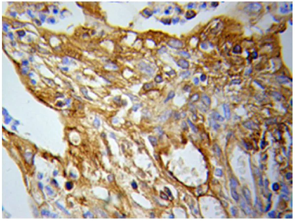 Immunohistochemistry (Formalin/PFA-fixed paraffin-embedded sections) - Anti-PKM antibody - N-terminal (AB196560)