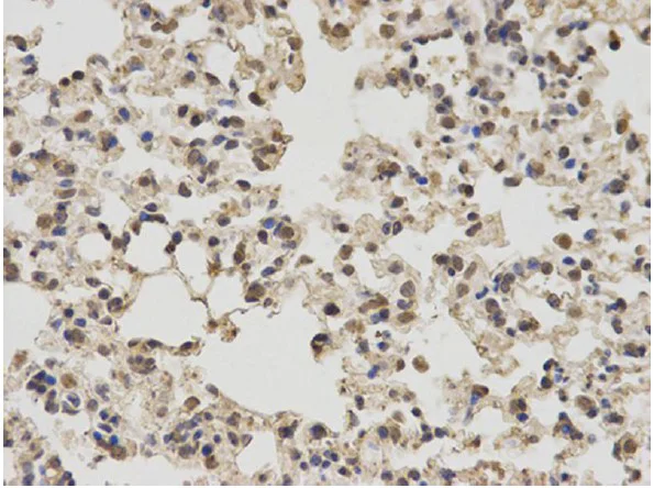 Immunohistochemistry (Formalin/PFA-fixed paraffin-embedded sections) - Anti-PKM antibody - N-terminal (AB196560)
