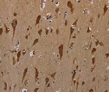 Immunohistochemistry (Formalin/PFA-fixed paraffin-embedded sections) - Anti-PKMYT1 antibody (AB200387)