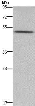 Western blot - Anti-PKMYT1 antibody (AB200387)