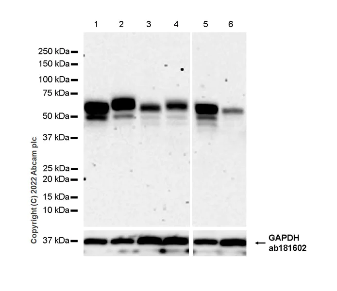 Western blot - Anti-PKMYT1 antibody [EPR27155-51] (AB307146)
