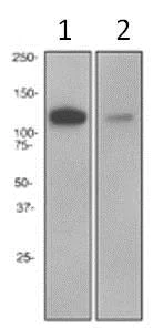Western blot - Anti-PKN antibody [EPR3237] (AB108976)