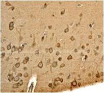 Immunohistochemistry (Formalin/PFA-fixed paraffin-embedded sections) - Anti-PKN antibody [EPR3237] - BSA and Azide free (AB247729)