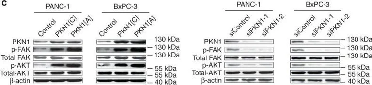 Western blot - Anti-PKN1 antibody [EPR18808] (AB195264)
