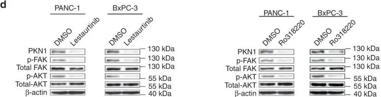 Western blot - Anti-PKN1 antibody [EPR18808] (AB195264)