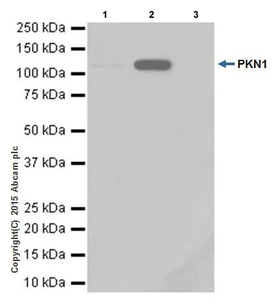 Immunoprecipitation - Anti-PKN1 antibody [EPR18808] - BSA and Azide free (AB251202)