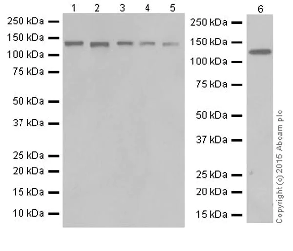 Western blot - Anti-PKN1 antibody [EPR18808] - BSA and Azide free (AB251202)