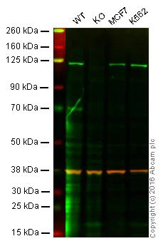 Western blot - Anti-PKN1 antibody [EPR18808] - BSA and Azide free (AB251202)