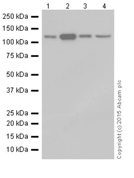 Western blot - Anti-PKN1 antibody [EPR18808] - BSA and Azide free (AB251202)