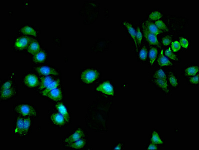 Immunocytochemistry/ Immunofluorescence - Anti-PKN2 antibody (AB238334)