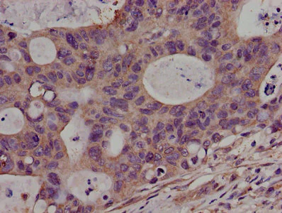 Immunohistochemistry (Formalin/PFA-fixed paraffin-embedded sections) - Anti-PKN2 antibody (AB238334)