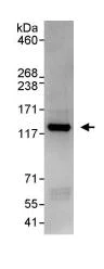 Immunoprecipitation - Anti-PKN2 antibody (AB87812)
