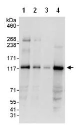 Western blot - Anti-PKN2 antibody (AB87812)