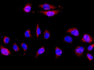 Immunocytochemistry/ Immunofluorescence - Anti-PKN2 antibody [EPR5490] (AB138514)