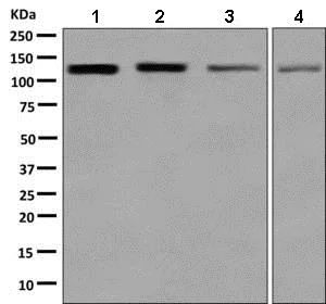 Western blot - Anti-PKN2 antibody [EPR5490] (AB138514)