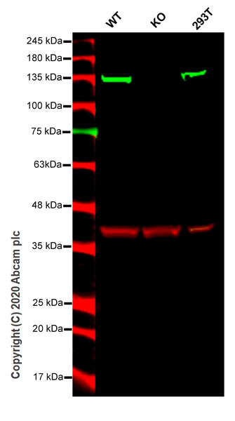 Western blot - Anti-PKN2 antibody [EPR5490] (AB138514)