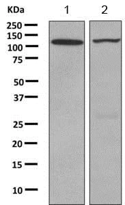 Western blot - Anti-PKN3 antibody [EPR3511(2)] (AB155076)