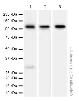 Western blot - Anti-PKN3 antibody [EPR3511(2)] (AB155076)